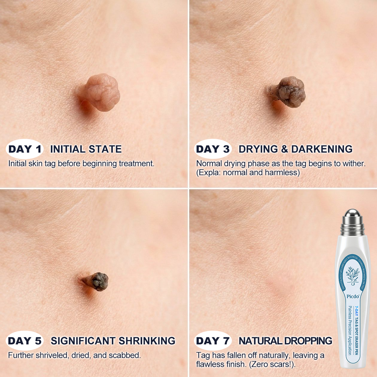 🔥𝟕-𝐃𝒂𝐲 Skincare Ro𝗜𝗜erba𝗜𝗜 Pen